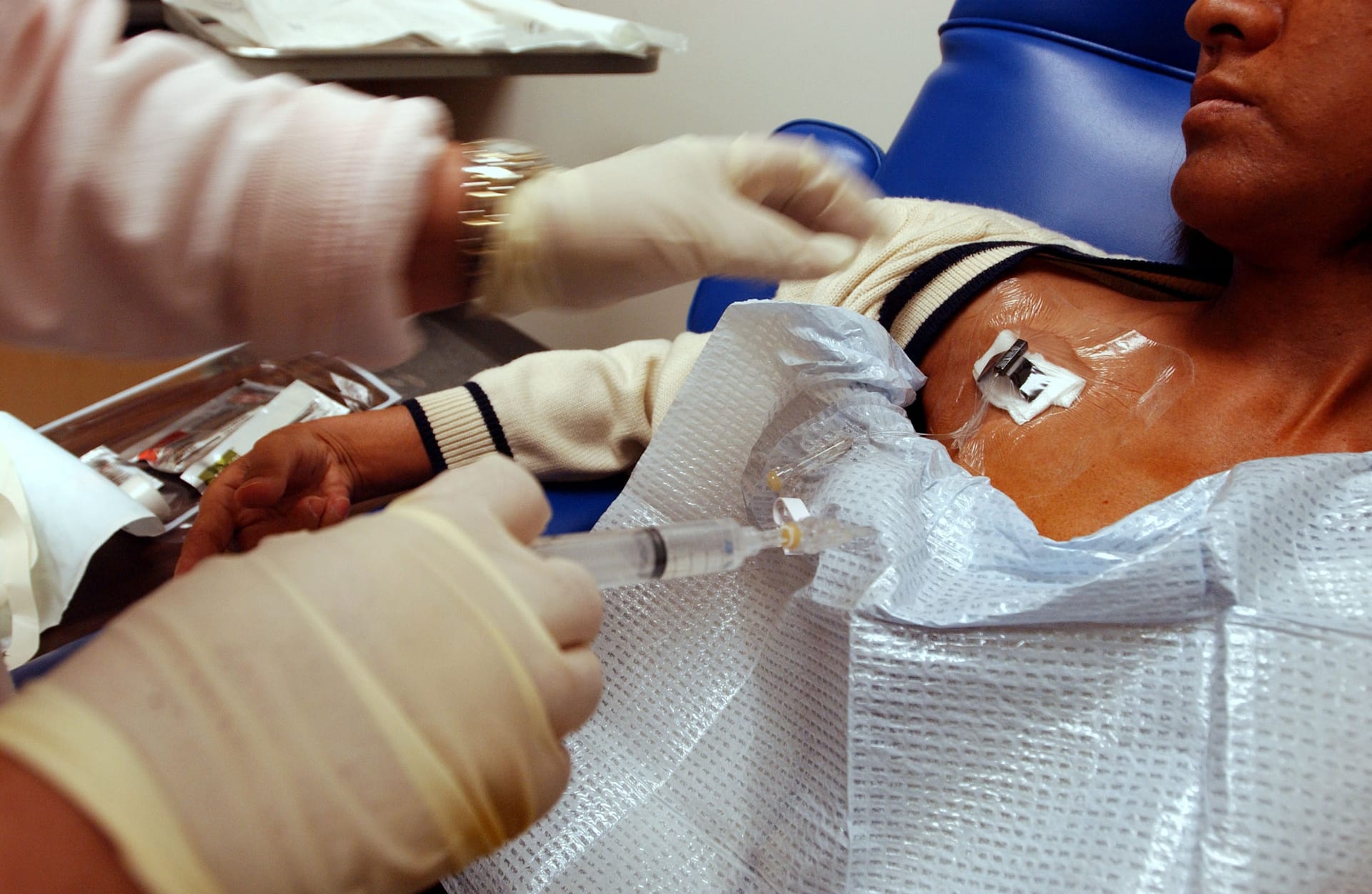 Tuberkulosefälle in den USA erreichen Höchststand seit Jahrzehnten: Gesundheitsexperten schlagen Alarm