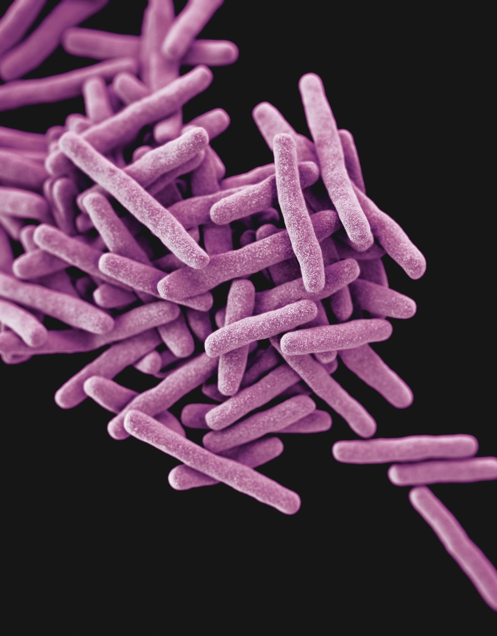 MedPage Today: Shorter TB regimen matched standard care in rifampicin-resistant disease