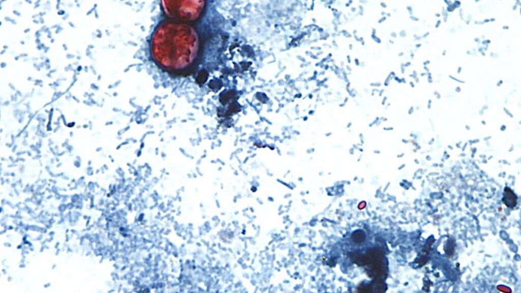 Two deaths reported from cyclospora outbreak in Michigan