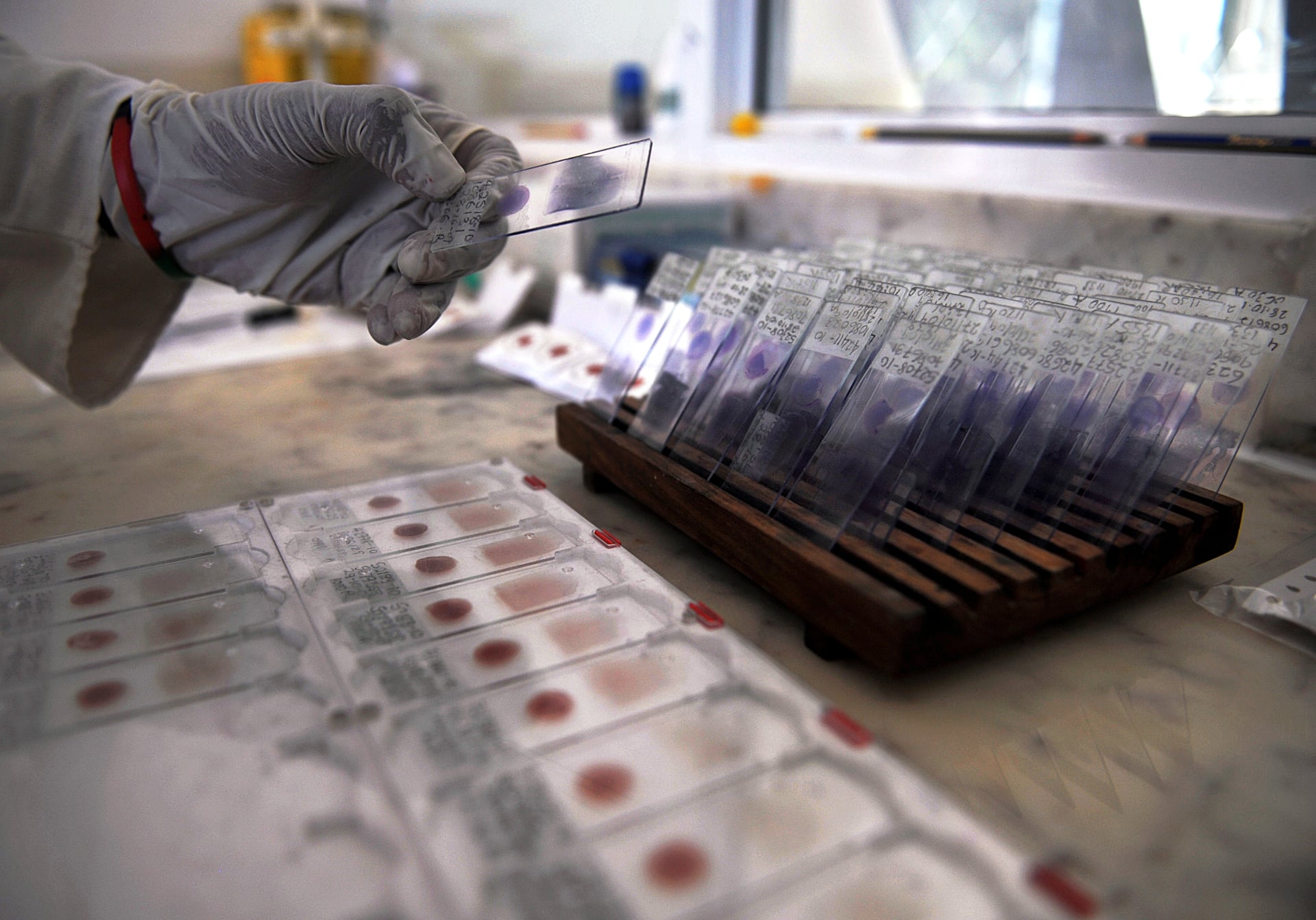 Die Malaria-Testabteilung der CDC wurde noch stärker gekürzt als das Tollwut-Labor