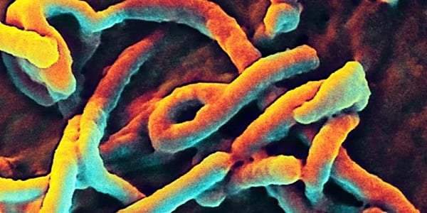 L'epidemia di Ebola a Bundibugyo supera i 5.700 casi senza un vaccino validato