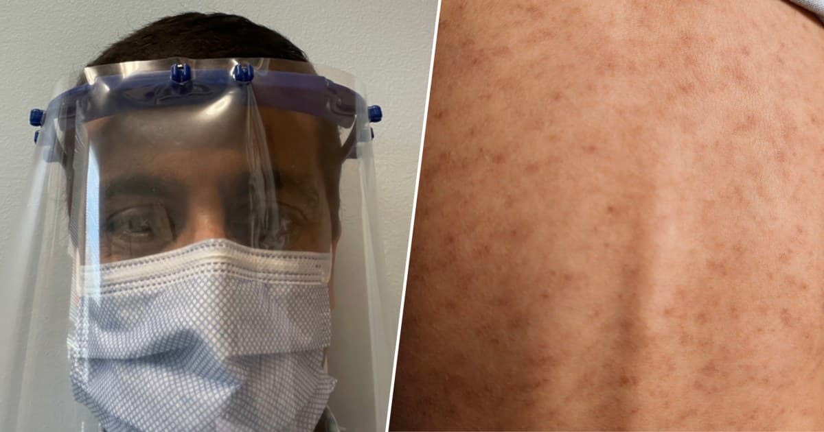 I’m a Doctor Who Treated Measles in the 2015 Outbreak. 7 Things People Keep Getting Wrong