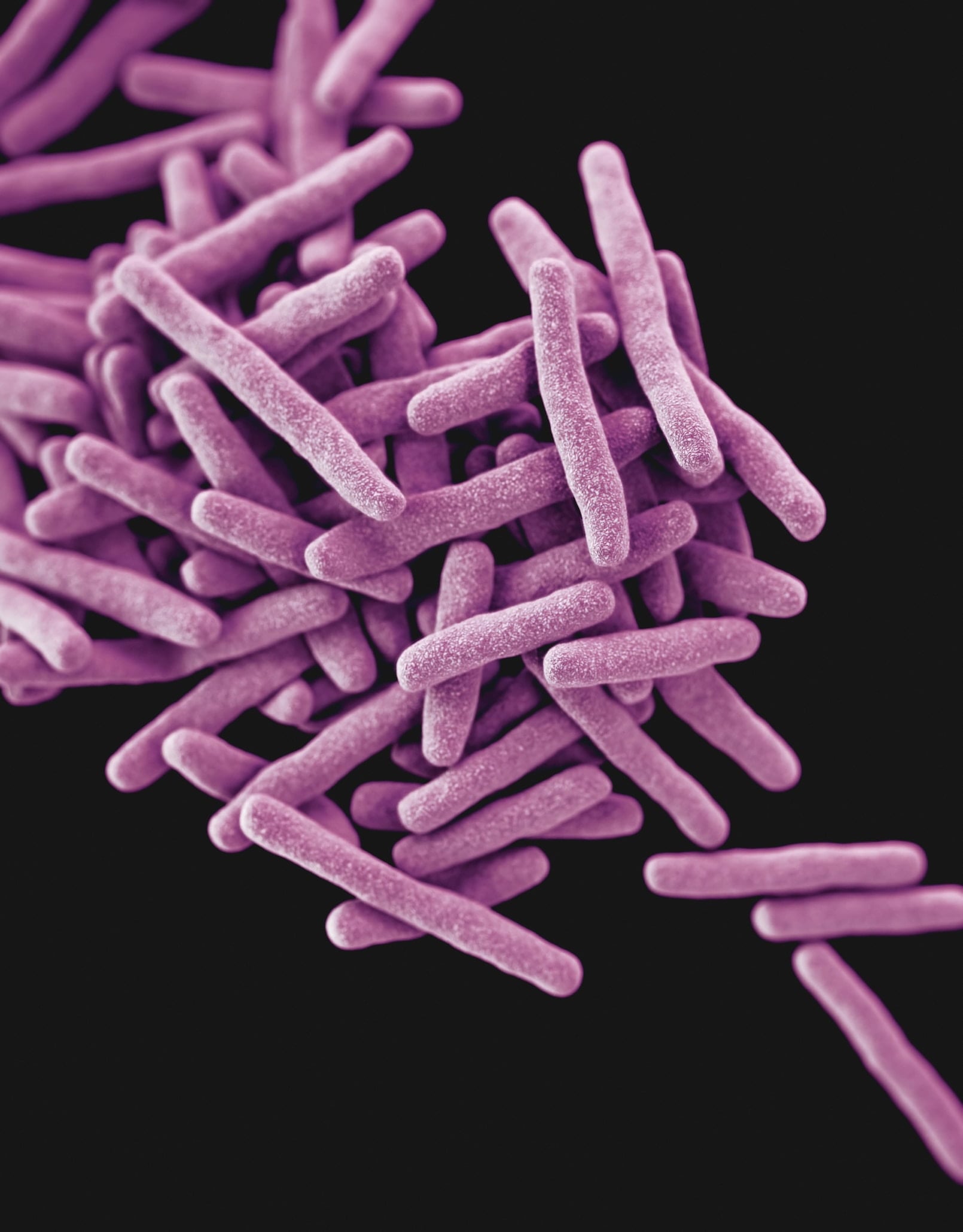 MedPage Today: Korter TB-behandelingsschema is gelijkwaardig aan standaardzorg bij rifampicine-resistente ziekte