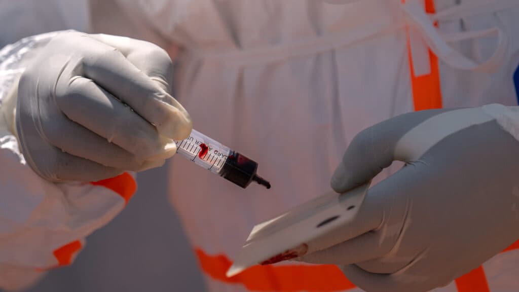 Ebola-Ausbruch offenbart ungelernte Lektion: Früherkennung ist entscheidend